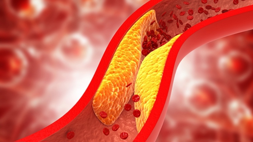 Việc tiếp xúc ít với ánh nắng mặt trời có thể làm tăng cholesterol xấu (Ảnh: Internet)